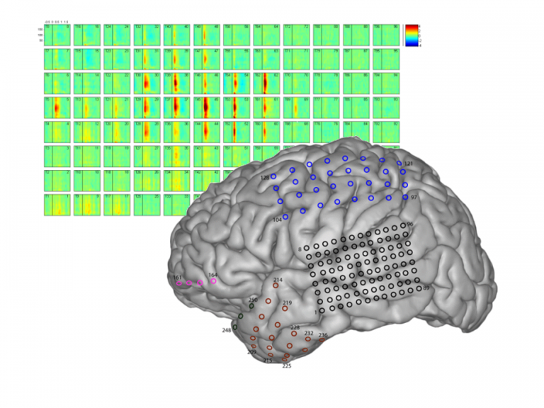 Brain chart examples